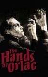 The Hands of Orlac