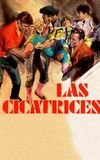 Las cicatrices