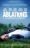 Ablations