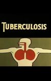 Health for the Americas: Tuberculosis