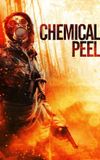 Chemical Peel